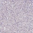 Immunohistochemical staining of human liver shows very weak nuclear positivity in hepatocytes.
