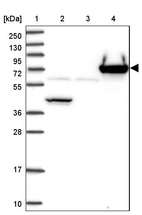 Lane 1: Marker [kDa] 250, 130, 95, 72, 55, 36, 28, 17, 10_br/_Lane 2: Human cell line RT-4_br/_Lane 3: Human cell line U-251MG sp_br/_Lane 4: Human plasma (IgG/HSA depleted)
