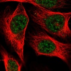 Anti-C19orf47 Antibody