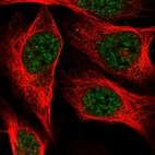 Immunofluorescent staining of human cell line U-2 OS shows localization to nucleoplasm.