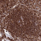 Anti-ZBTB8OS Antibody