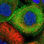 Immunofluorescent staining of human cell line A-431 shows localization to plasma membrane.