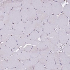 Immunohistochemical staining of human skeletal muscle shows no positivity in myocytes as expected.