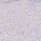 Immunohistochemical staining of human liver shows no positivity in hepatocytes as expected.