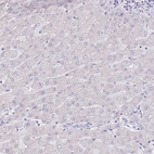 Immunohistochemical staining of human liver shows no positivity in hepatocytes as expected.