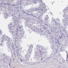 Immunohistochemical staining of human prostate shows no positivity in glandular cells as expected.
