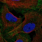 Immunofluorescent staining of human cell line U-2 OS shows localization to plasma membrane.