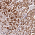 Anti-MRPS31 Antibody