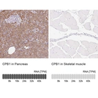 Anti-CPB1 Antibody
