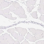 Immunohistochemical staining of human skeletal muscle shows low expression as expected.