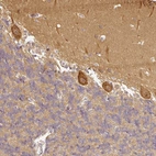Anti-ANKRD18A Antibody