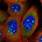 Immunofluorescent staining of human cell line A-431 shows localization to nucleoli & cytosol.