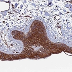 Anti-TMC2 Antibody