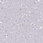 Immunohistochemical staining of human cerebral cortex shows low expression as expected.
