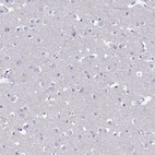 Anti-FAM160A1 Antibody