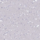 Immunohistochemical staining of human cerebral cortex shows low expression as expected.