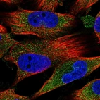 Immunofluorescent staining of human cell line U-251 MG shows localization to cytosol.