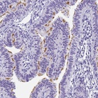 Immunohistochemical staining of human fallopian tube shows high expression.