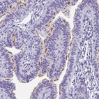 Immunohistochemical staining of human fallopian tube shows high expression.
