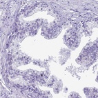 Immunohistochemical staining of human prostate shows low expression as expected.