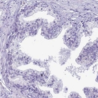 Immunohistochemical staining of human prostate shows low expression as expected.