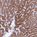 Anti-KNCN Antibody