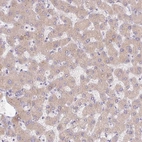 Anti-C4A Antibody