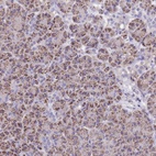 Anti-ELP6 Antibody