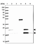 Lane 1: Marker [kDa] 250, 130, 95, 72, 55, 36, 28, 17, 10_br/_Lane 2: Human cell line RT-4_br/_Lane 3: Human cell line U-251MG sp_br/_Lane 4: Human plasma (IgG/HSA depleted)_br/_Lane 5: Human liver tissue_br/_Lane 6: Human tonsil tissue
