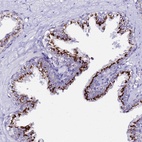 Anti-PRY Antibody