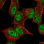 Immunofluorescent staining of human cell line SH-SY5Y shows localization to nucleoplasm, plasma membrane & peroxisomes.