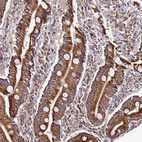Immunohistochemical staining of human duodenum shows strong granular cytoplasmic positivity in glandular cells.