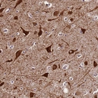 Immunohistochemical staining of human cerebral cortex shows strong cytoplasmic positivity in neurons.