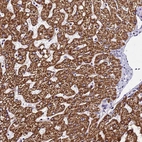 Immunohistochemical staining of human liver shows strong positivity in cytoplasm granular in hepatocytes.