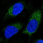 Immunofluorescent staining of human cell line U-2 OS shows localization to cytosol.