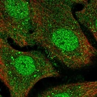Immunofluorescent staining of human cell line A549 shows localization to nucleus, cytosol & cell junctions.