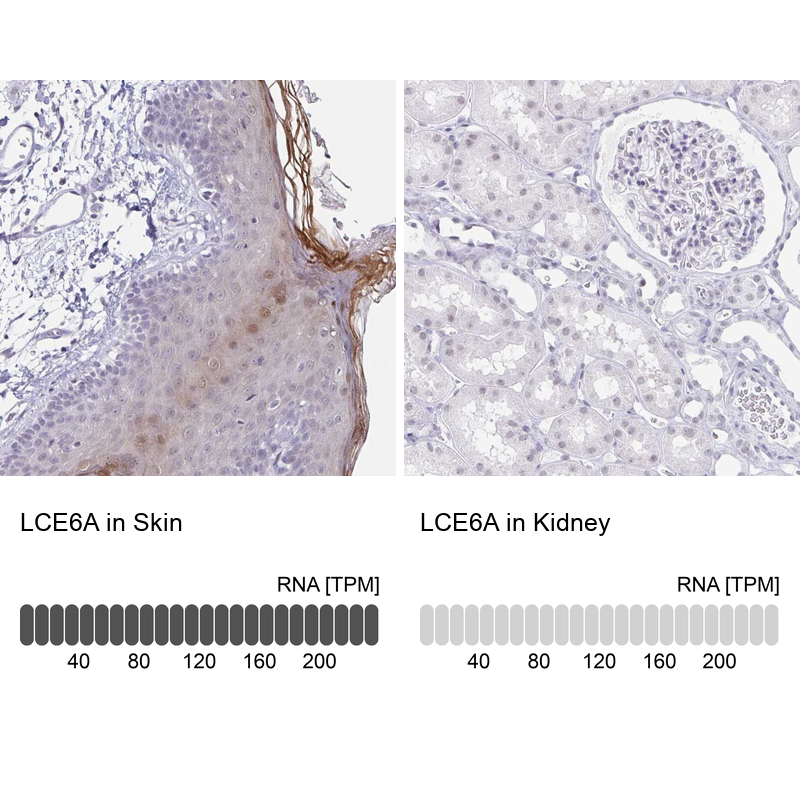 Anti-LCE6A Antibody