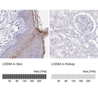 Anti-LCE6A Antibody
