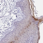 Immunohistochemical staining of human skin shows high expression.
