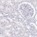 Immunohistochemical staining of human kidney shows low expression as expected.