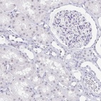 Anti-LCE6A Antibody