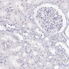 Immunohistochemical staining of human kidney shows low expression as expected.