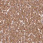 Anti-DDX19B Antibody