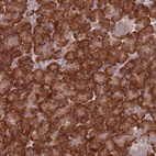 Anti-RPL17 Antibody