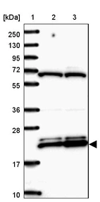 Lane 1: Marker [kDa] 250, 130, 95, 72, 55, 36, 28, 17, 10_br/_Lane 2: Human cell line RT-4_br/_Lane 3: Human cell line U-251MG sp