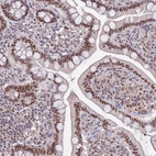 Immunohistochemical staining of human small intestine shows strong nuclear positivity in glandular cells.