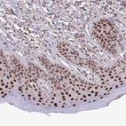 Immunohistochemical staining of human skin shows strong nuclear positivity in squamous epithelial cells.