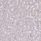 Immunohistochemical staining of human liver shows no positivity in hepatocytes as expected.
