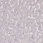 Immunohistochemical staining of human liver shows no positivity in hepatocytes as expected.