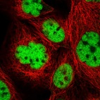 Immunofluorescent staining of human cell line A-431 shows localization to nucleoplasm.